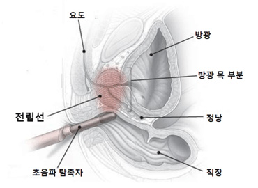 모식도