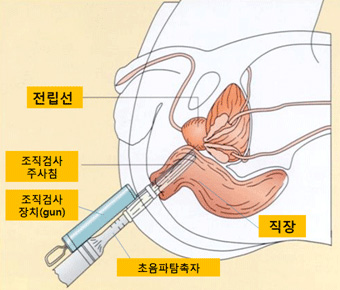 모식도